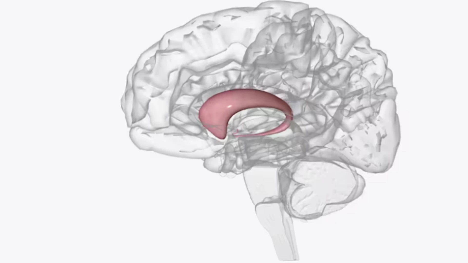 Brain Aneurysm: The Silent Bulge That Demands Attention