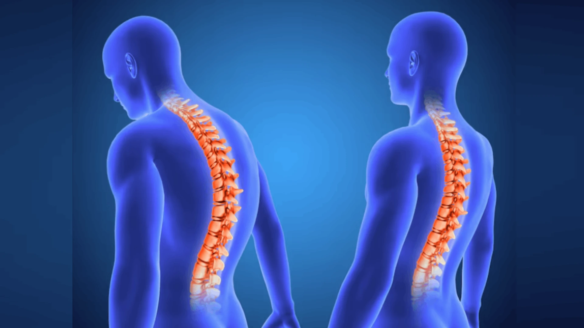 Brain & Spinal Cord Injuries: Trauma to the Central Nervous System