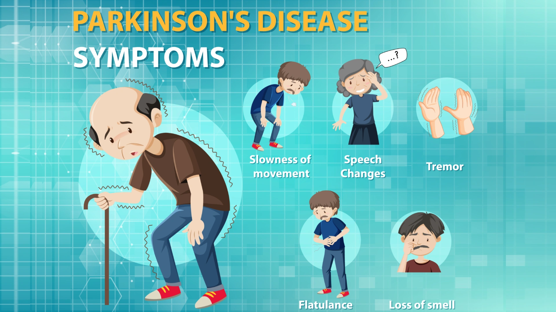 What is Parkinson’s Disease?